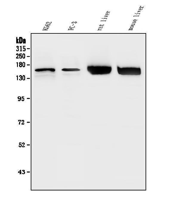  Western blot analysis of HDAC5 using anti-HDAC5 antibody (A01230-6)