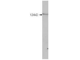 Western Blot of Rabbit anti-HDAC5 antibody