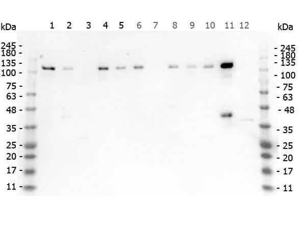 Western Blot of Rabbit anti-HDAC5 antibody