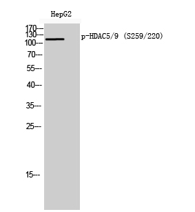 Western blotting validation for Anti-Phospho-HDAC5/9 (S259/220) Antibody A01230S259
Western Blot (WB) analysis of HepG2 cells using Phospho-HDAC5/9 (S259/220) polyclonal antibody