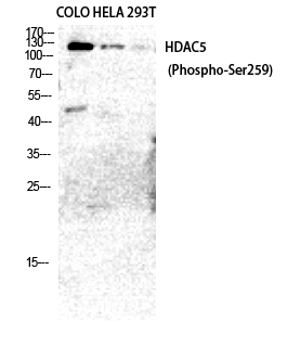 Western blotting validation for Anti-Phospho-HDAC5/9 (S259/220) Antibody A01230S259
Western Blot (WB) analysis of COLO205 HeLa 293T cells using Phospho-HDAC5/9 (S259/220) polyclonal antibody