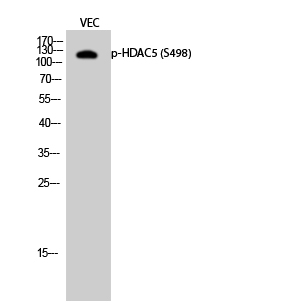 Western Blot analysis of VEC cells using Phospho-HDAC5 (S498) Polyclonal Antibody diluted at 1:500