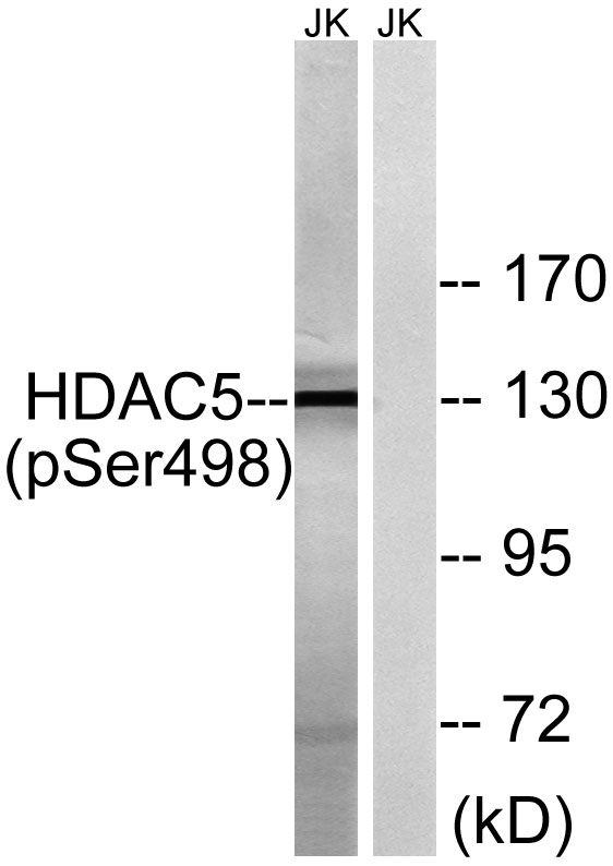 Western blot analysis of lysates from Jurkat cells, using HDAC5 (Phospho-Ser498) Antibody