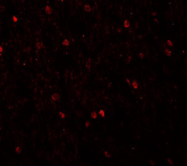 Immunofluorescence of SHANK3 in human brain tissue with SHANK3 antibody at 20 μg/mL