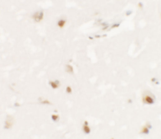 Immunohistochemistry of SHANK3 in human brain tissue with SHANK3 antibody at 2