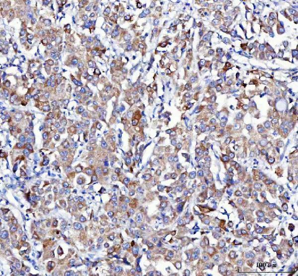 a01232 1 aplp2 primary antibodies ihc testing 4