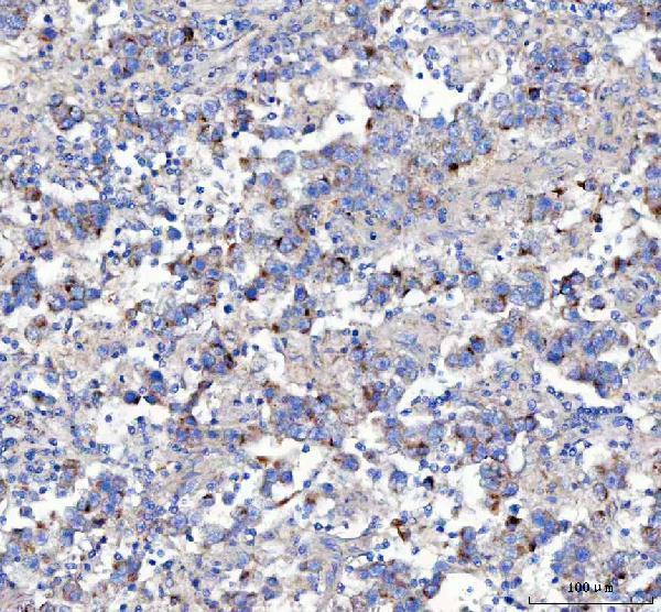a01232 1 aplp2 primary antibodies ihc testing 5