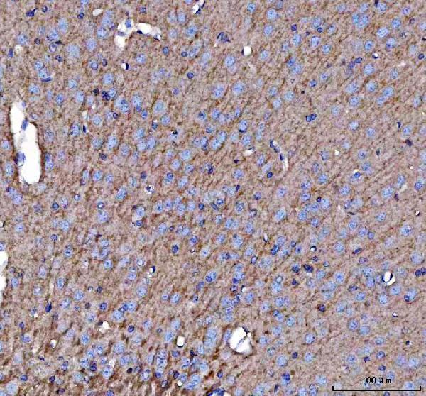a01232 1 aplp2 primary antibodies ihc testing 6