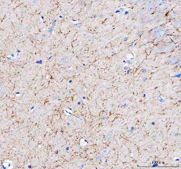 a01232 1 aplp2 primary antibodies ihc testing 7