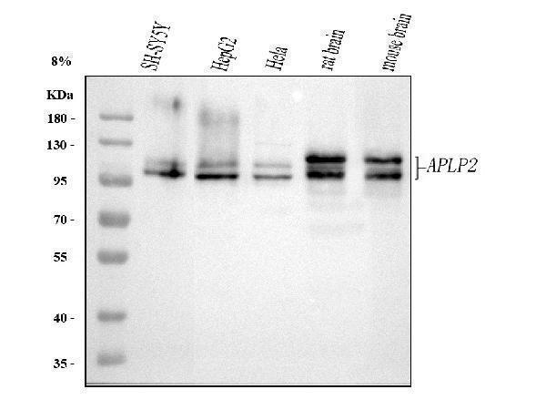  Western blot analysis of APLP2 using anti-APLP2 antibody (A01232-1)