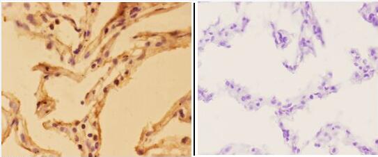 a01232y274 aplp2 primary antiboties ihc testing 2