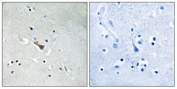 a01232y755 aplp2 primary antibodies ihc testing 1