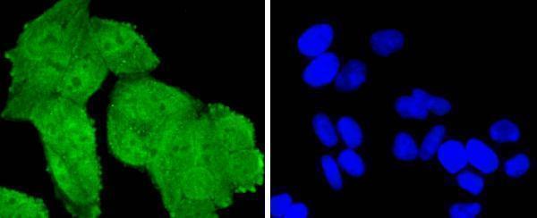 ICC staining TSG101 in Hela cells (green)