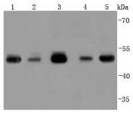 Western blot analysis of TSG101 on different lysates using anti-TSG101 antibody at 1/1,000 dilution