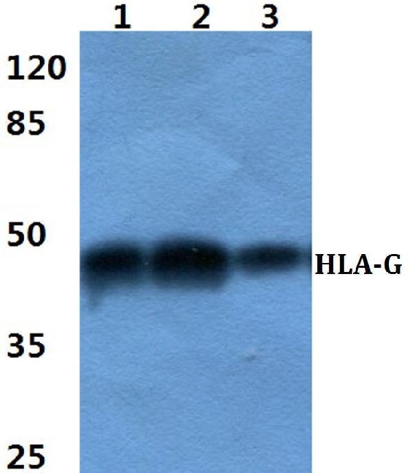 a01235 hla g primary antiboties wb testing 1