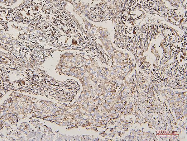 a01240 2 lpp primary antibodies ihc testing 2