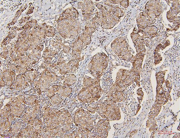 a01240 2 lpp primary antibodies ihc testing 3