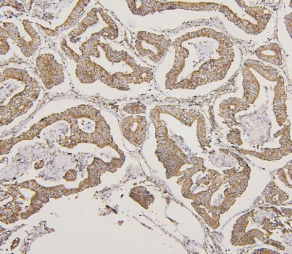 a01240 2 lpp primary antibodies ihc testing 4