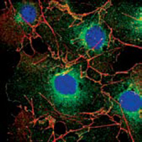a01240 lpp primary antibodies if testing 1