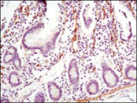 a01240 lpp primary antibodies ihc testing 3