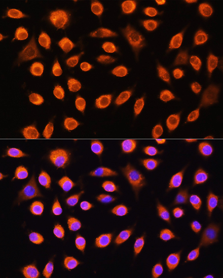 Immunofluorescence analysis of L929 cells using GNAS Rabbit pAb  at dilution of 1:100