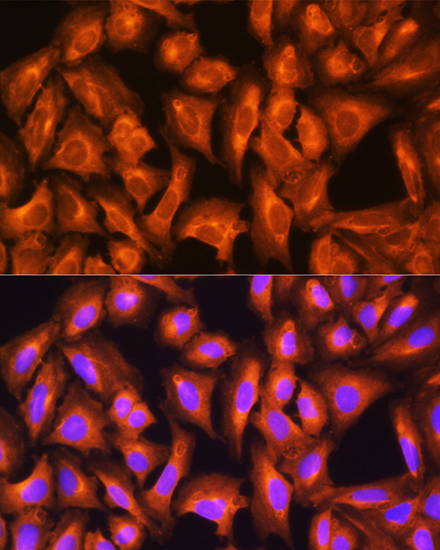 Immunofluorescence analysis of U2OS cells using GNAS Rabbit pAb  at dilution of 1:100