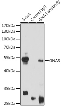 a01243 gnas primary antiboties ip testing 4