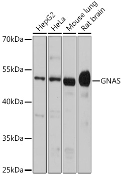 Western blot analysis of extracts of various cell lines, using GNAS antibody  at 1:1000 dilution