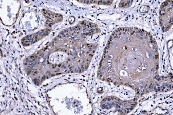  IHC analysis of p57 Kip2/CDKN1C using anti-p57 Kip2/CDKN1C antibody (A01244-2)