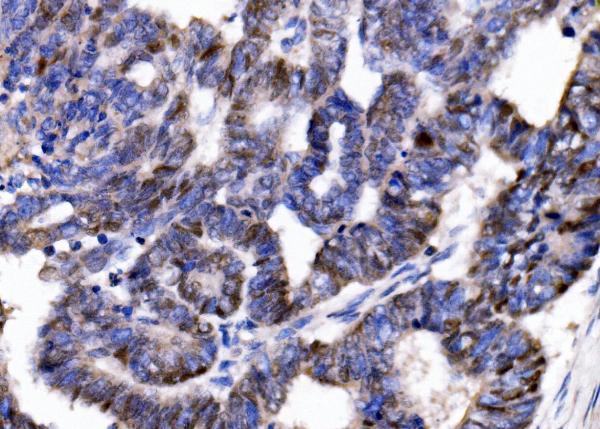  IHC analysis of p57 Kip2/CDKN1C using anti-p57 Kip2/CDKN1C antibody (A01244-2)