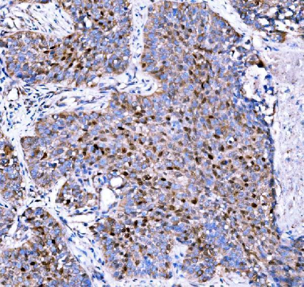 a01244 2 cdkn1c primary antibodies ihc testing 4