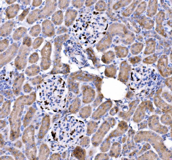 a01244 2 cdkn1c primary antibodies ihc testing 5