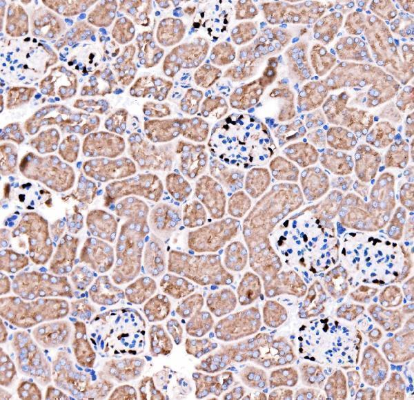 a01244 2 cdkn1c primary antibodies ihc testing 6