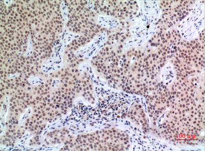 a01244 cdkn1c primary antibodies ihc testing 1