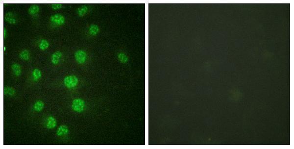 Immunofluorescence analysis of HUVEC cells treated with serum 20% 30