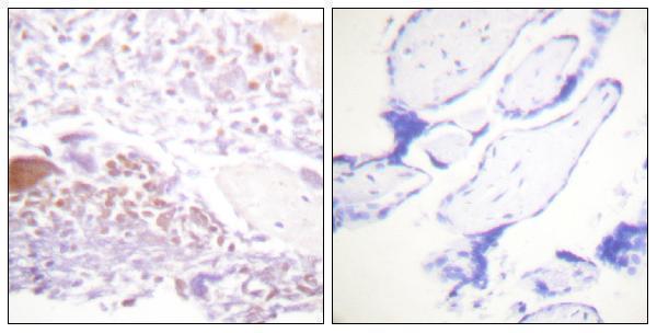 Immunohistochemistry analysis of paraffin-embedded human placenta, using p57 Kip2 (Phospho-Thr310) Antibody