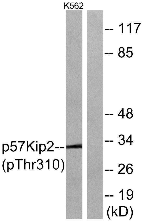 Western blot analysis of lysates from K562 cells treated with insulin 0