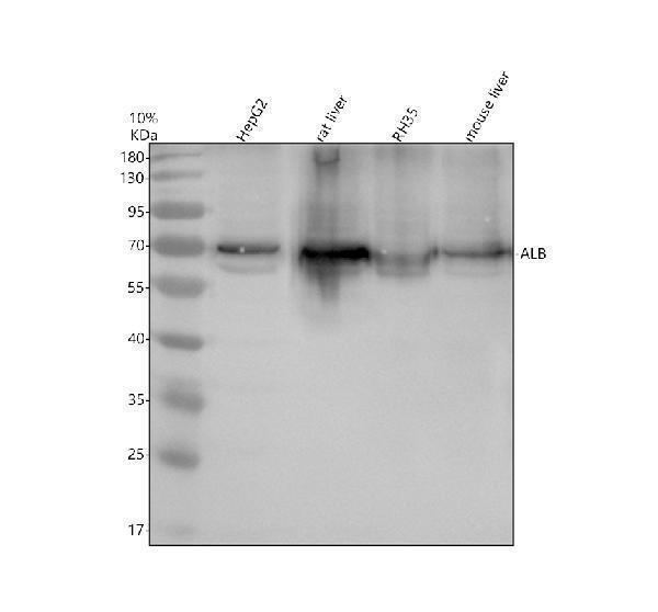 Western blot analysis of ALB using anti-ALB antibody (A01245-4)