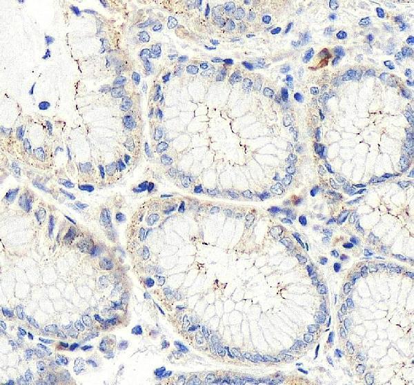 IHC analysis of Occludin/OCLN using anti-Occludin/OCLN antibody (A01246-4)