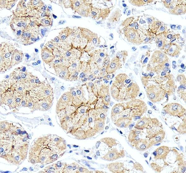 IHC analysis of Occludin/OCLN using anti-Occludin/OCLN antibody (A01246-4)