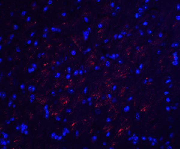 a01246 ocln primary antibodies if testing 5
