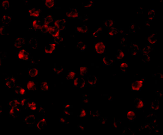 a01247 1 irak4 primary antibodies if testing 5