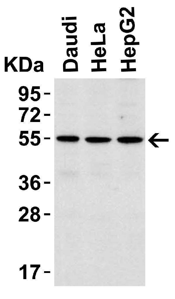 Western Blot Validation in Human Cell Lines
Loading: 15 μg/ of lysates per lane