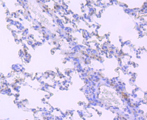 Immunohistochemical analysis of paraffin-embedded rat lung tissue using anti-HIF-2 alpha antibody