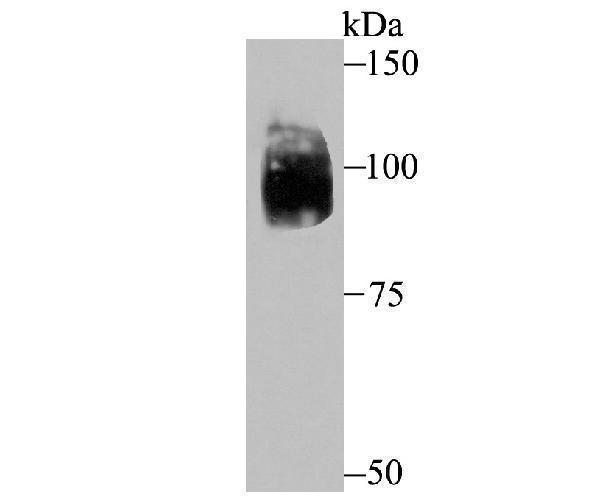 Western blot analysis of HIF-2 alpha on SiHa cell lysate using anti-HIF-2 alpha antibody at 1/500 dilution