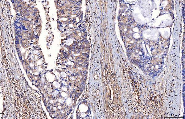  IHC analysis of ENO1 using anti-ENO1 antibody (A01250-2)