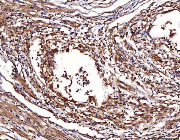  IHC analysis of ENO1 using anti-ENO1 antibody (A01250-2)