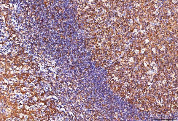 a01250 2 eno1 primary antibodies ihc testing 4