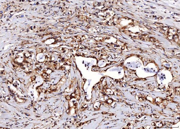 a01250 2 eno1 primary antibodies ihc testing 5