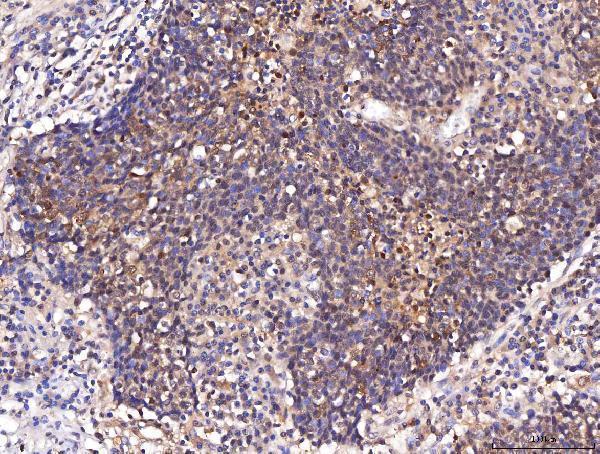 a01250 2 eno1 primary antibodies ihc testing 7